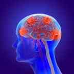 患有阿尔茨海默病的人类大脑的3d插图-痴呆